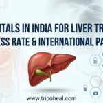 Best Liver Transplant Hospital in India