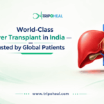 Liver Transplant in India for Foreign Patients