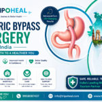 Gastric Bypass Surgery in India – Cost, Success Rate & Hospitals