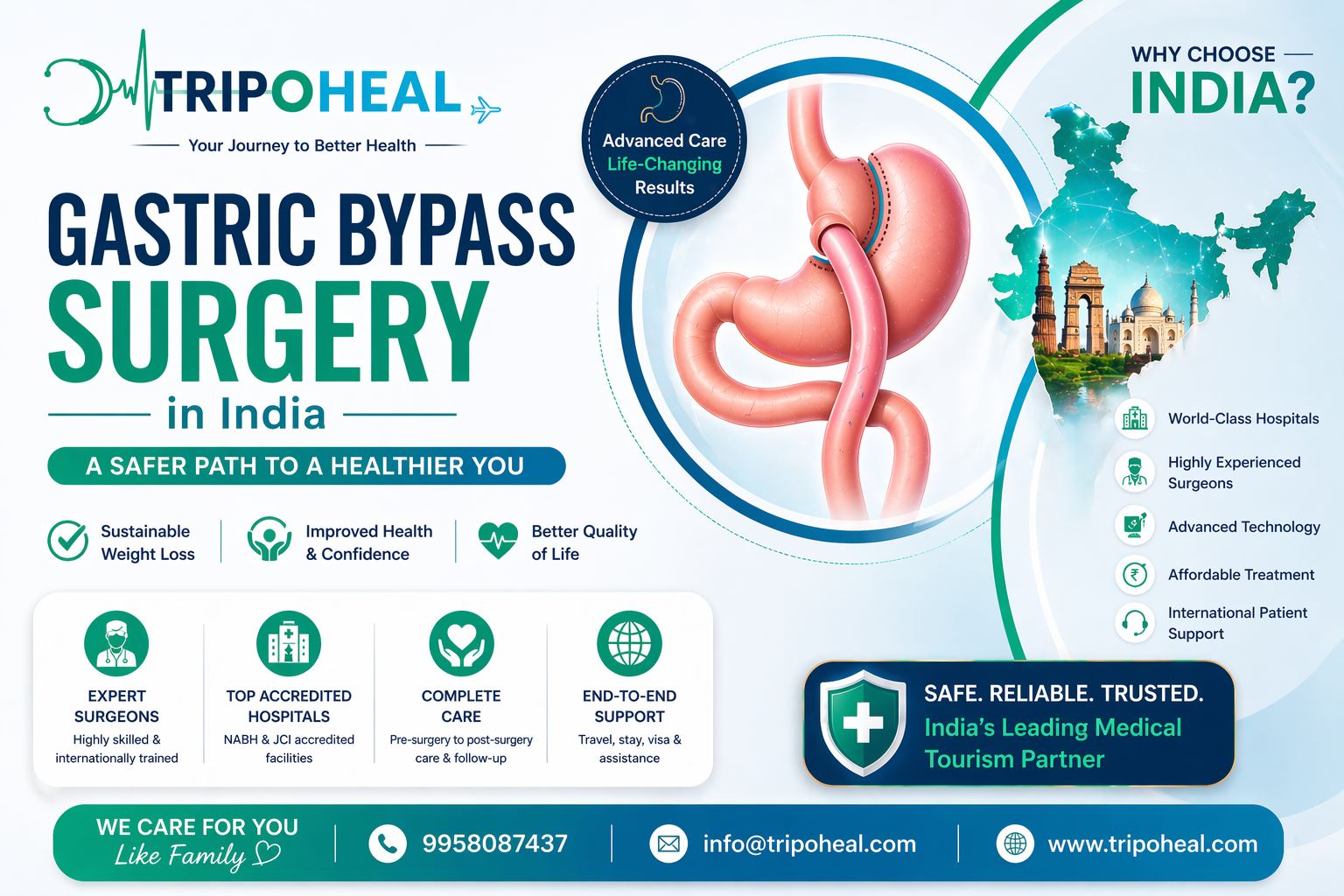 Gastric Bypass Surgery in India – Cost, Success Rate & Hospitals