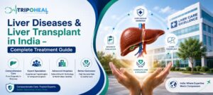 Read more about the article Liver Diseases & Liver Transplant in India – Complete Treatment Guide
