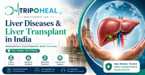 Read more about the article Liver Diseases & Liver Transplant in India – Complete Treatment Guide