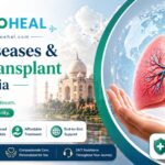 Lung Diseases & Lung Transplant in India – Complete Treatment Guide