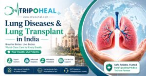 Read more about the article Lung Diseases & Lung Transplant in India – Complete Treatment Guide
