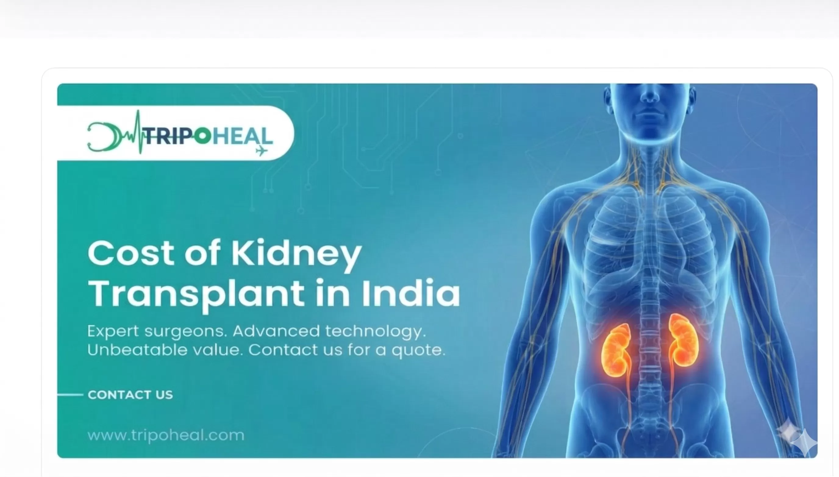 Kidney Transplant in India