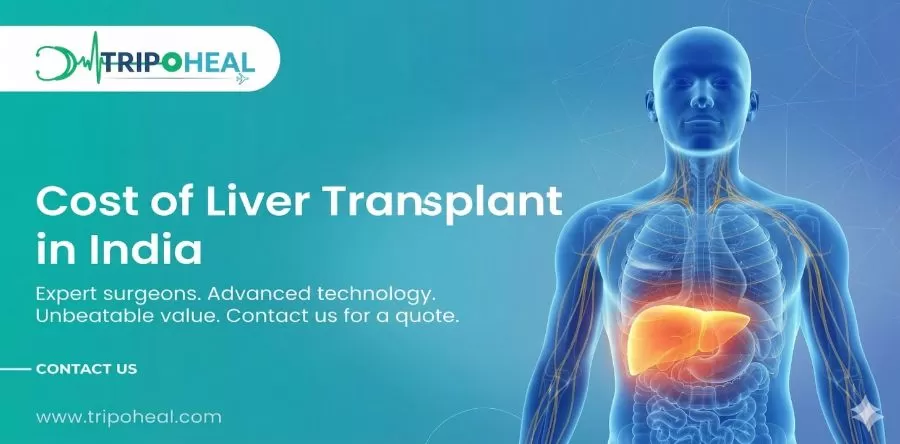 Cost of Liver Transplant in India