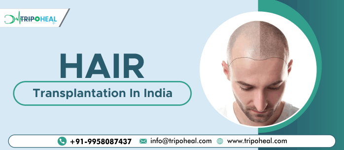 Hair transplant in India