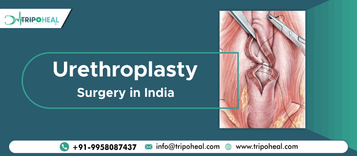 Urethroplasty Surgery in India
